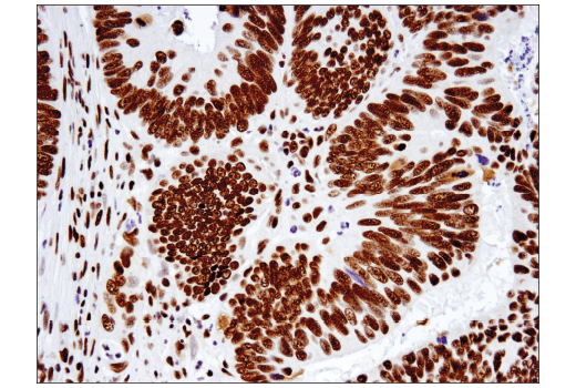 undefined Image 42: BAF Complex IHC Antibody Sampler Kit