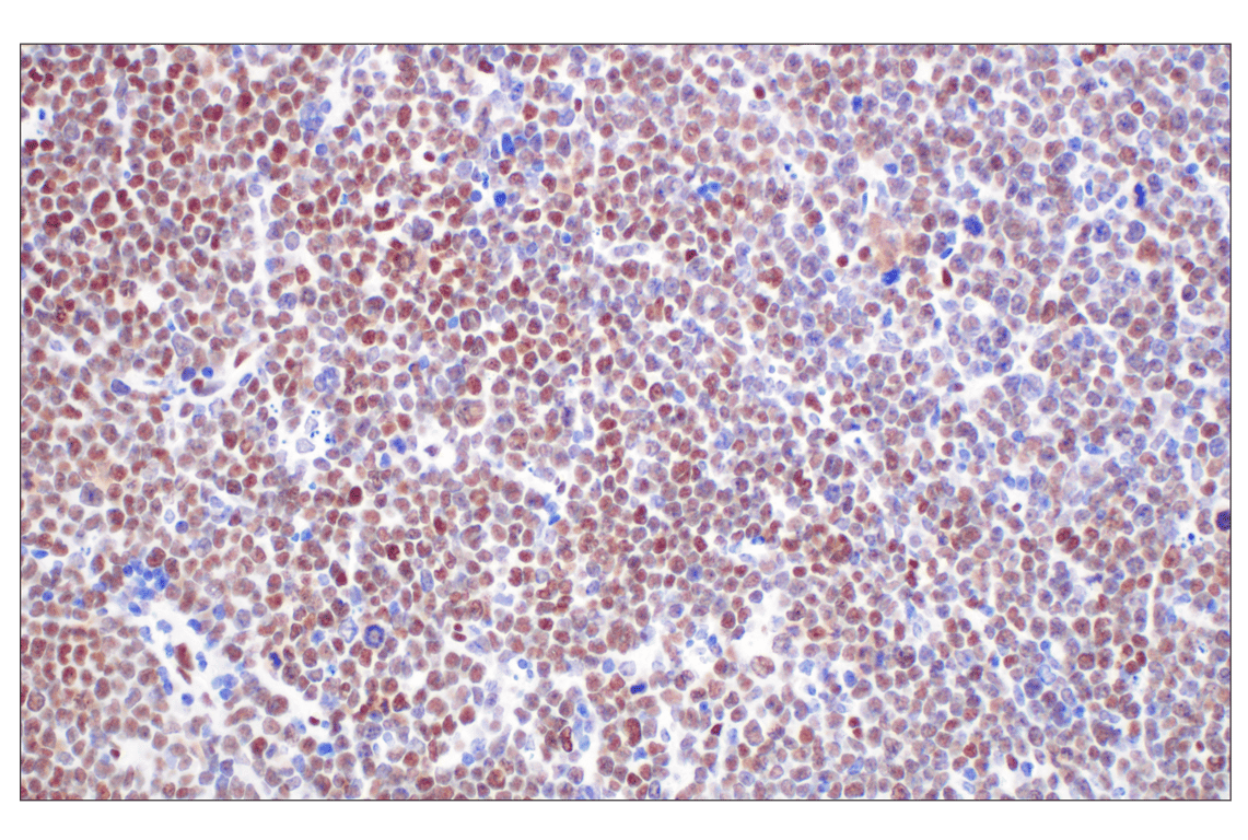 Immunohistochemistry Image 2: TCF4/ITF2 (E3X2Y) Rabbit Monoclonal Antibody