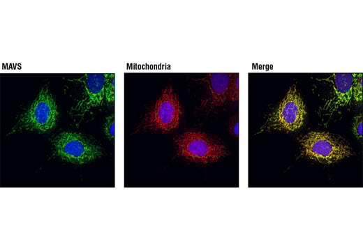 undefined Image 18: Rig-I Pathway Antibody Sampler Kit
