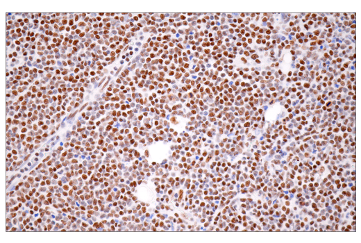 Immunohistochemistry Image 5: CPSF4 (E2L2Z) Rabbit Monoclonal Antibody