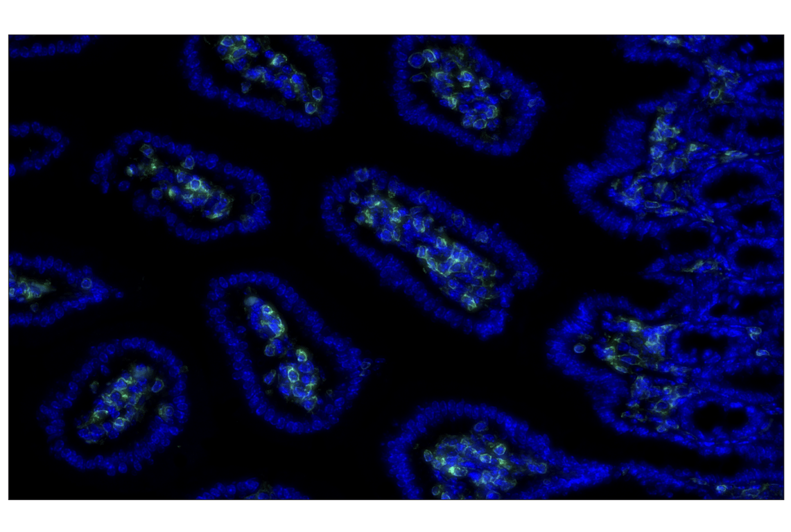 Immunohistochemistry Image 1: CD45 (D3F8Q) Rabbit Monoclonal Antibody (Alexa Fluor<sup>®</sup> 488 Conjugate)
