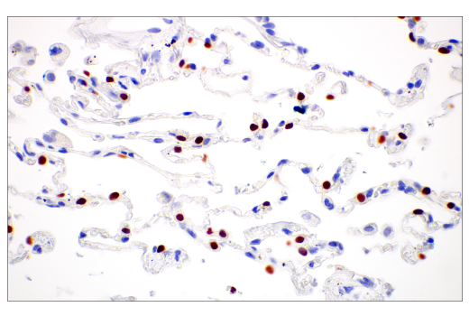 Immunohistochemistry Image 2: Thyroid Transcription Factor 1 (TTF-1) (SPT24) Mouse Monoclonal Antibody