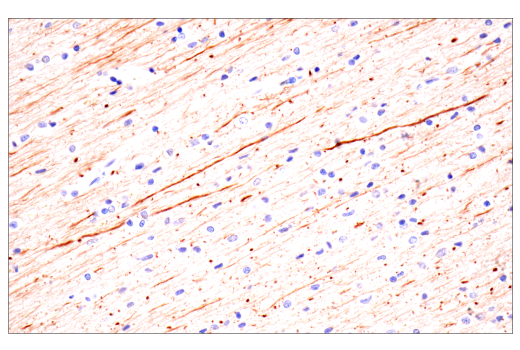 Immunohistochemistry Image 1: Neurofilament-H (E7Z7G) Rabbit Monoclonal Antibody (BSA and Azide Free)