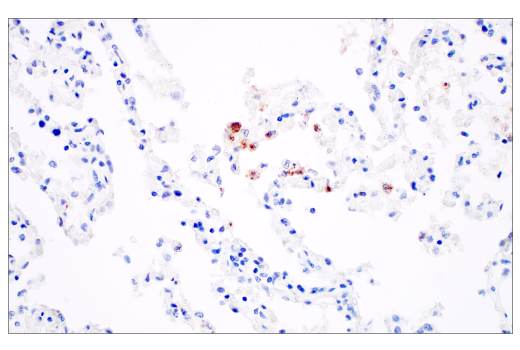 Immunohistochemistry Image 1: SARS-CoV-2 Nucleocapsid Protein (E9L7H) Rabbit Monoclonal Antibody