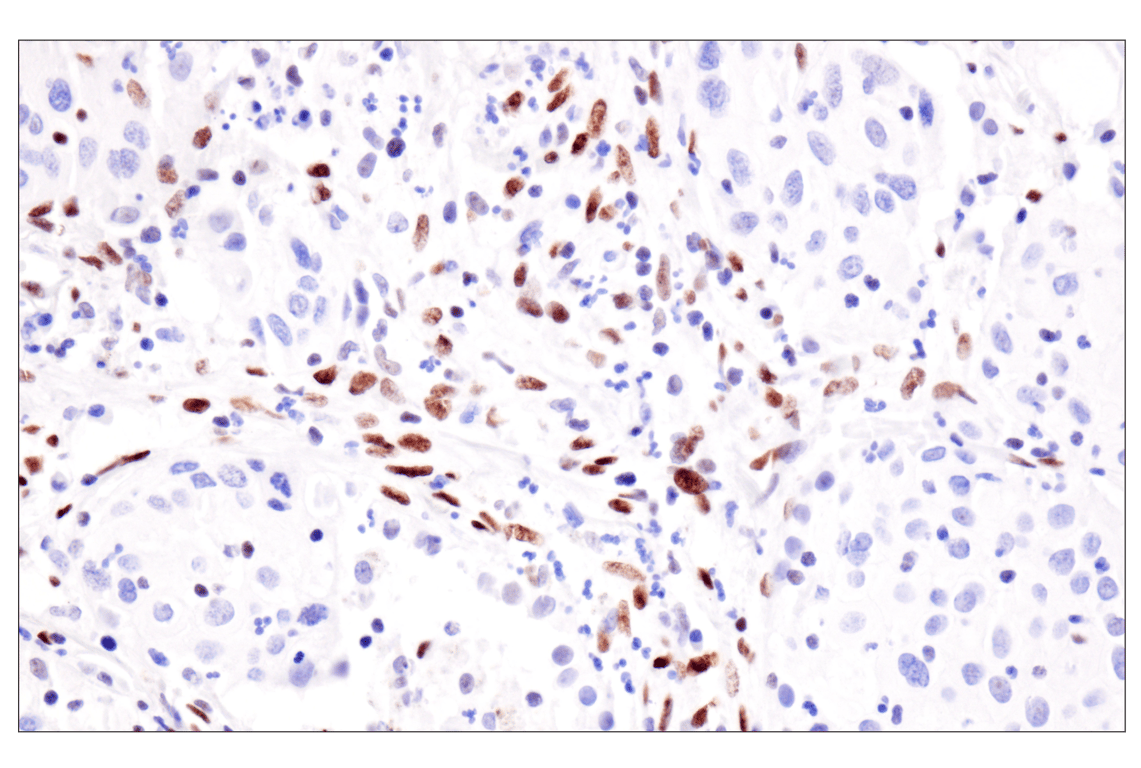 Immunohistochemistry Image 5: ADAR2 (F6U8S) Rabbit Monoclonal Antibody