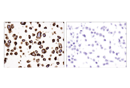 Immunohistochemistry Image 3: Bcl-2 (124) Mouse mAb (BSA and Azide Free)