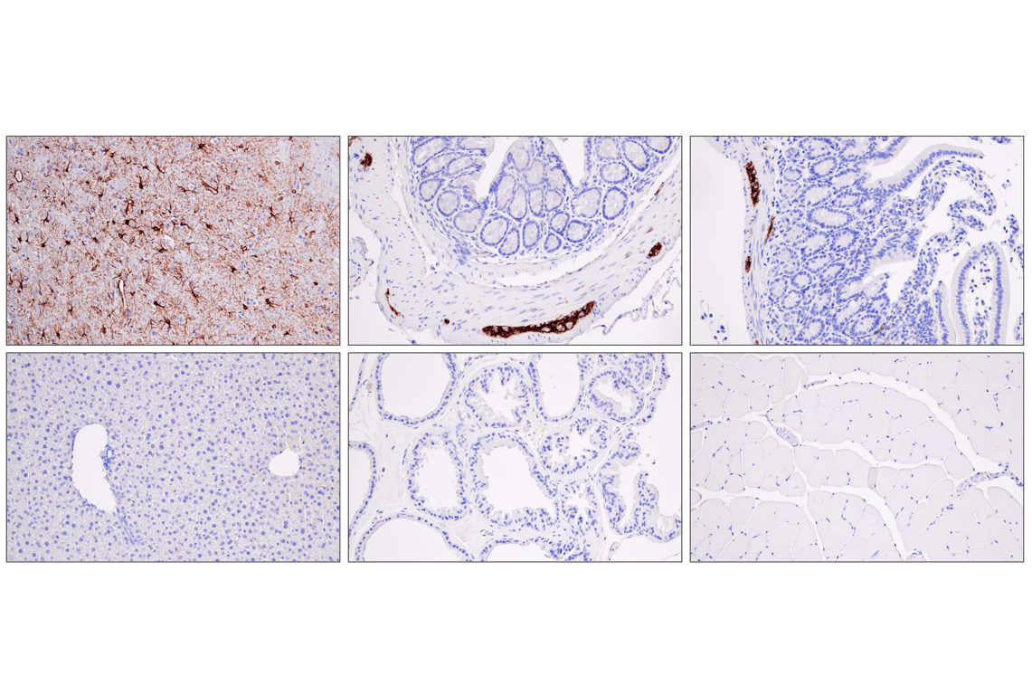 n.a.tページ GFAP (E4L7M) XP® Rabbit mAb | Cell Signaling Technology