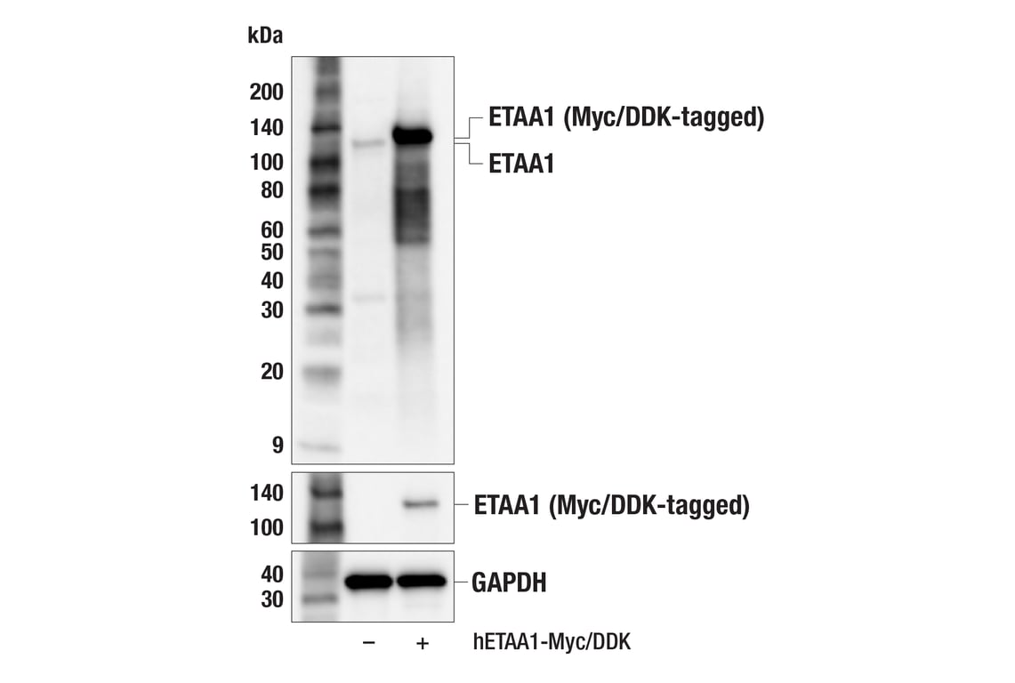 Western Blotting Image 2: ETAA1 (E8U8B) Rabbit Monoclonal Antibody