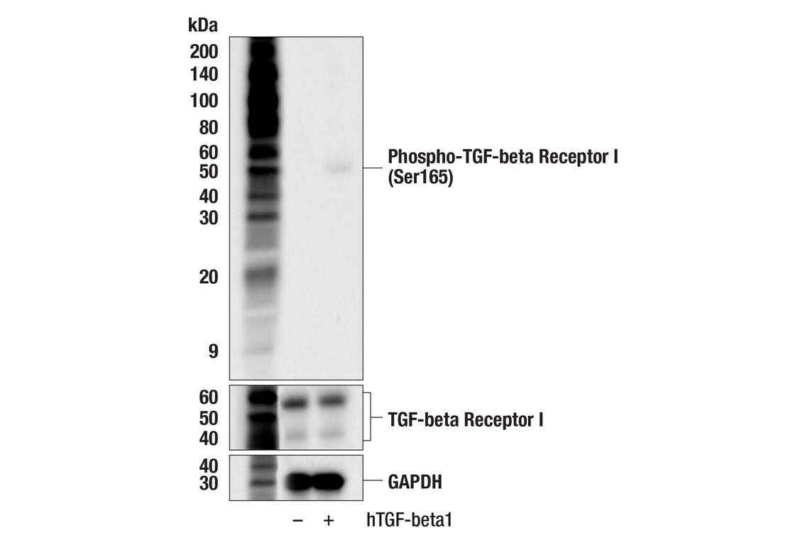 Western Blotting Image 2: Phospho-TGF-beta Receptor I (Ser165) (F5E2G) Rabbit Monoclonal Antibody