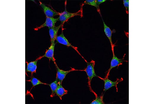undefined Image 19: Vesicle Trafficking Antibody Sampler Kit