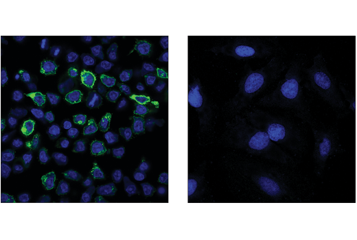 Immunofluorescence Image 1: 4-1BB/CD137/TNFRSF9 (D2Z4Y) Rabbit Monoclonal Antibody