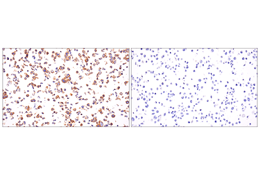 Immunohistochemistry Image 1: Insulin Receptor β (E9L5V) XP<sup>®</sup> Rabbit mAb (BSA and Azide Free)