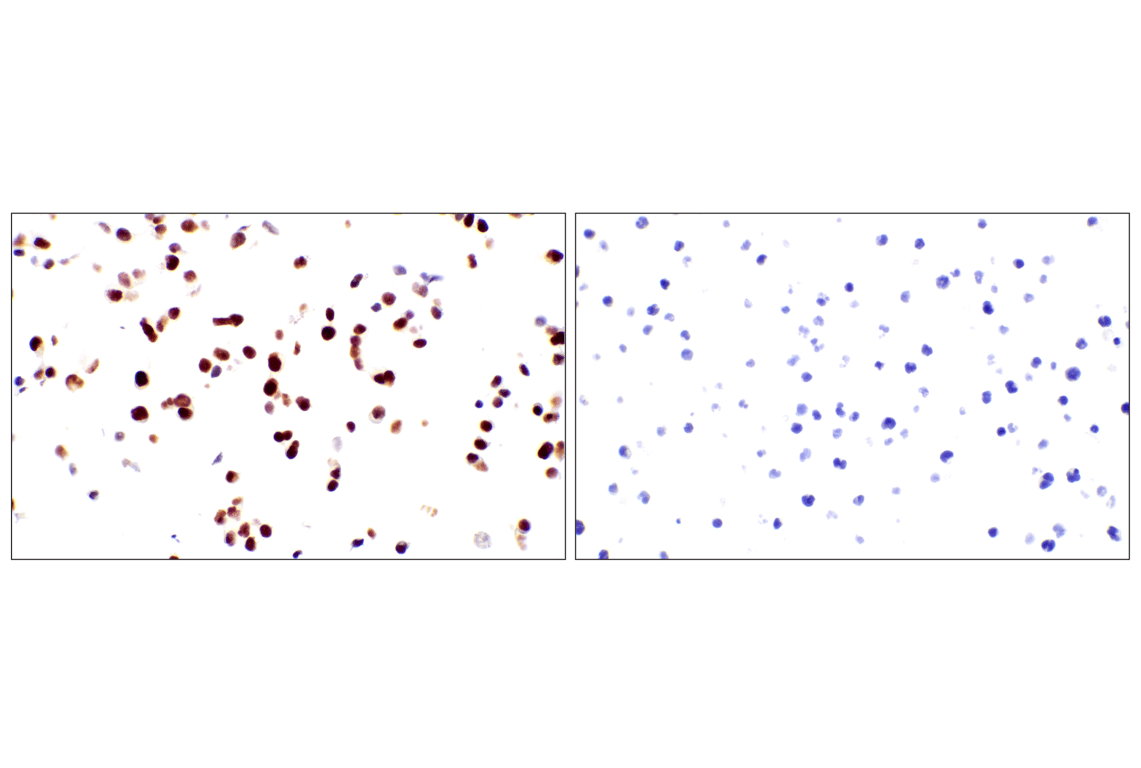 Immunohistochemistry Image 24: GATA-6 (D61E4) Rabbit Monoclonal Antibody