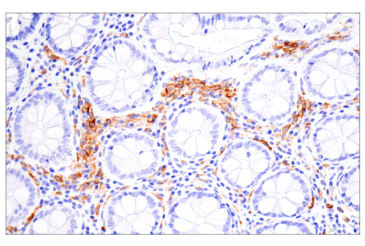 Immunohistochemistry Image 5: FcR gamma (E6Y1A) Rabbit Monoclonal Antibody (BSA and Azide Free)