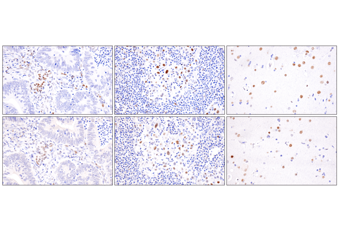 Immunohistochemistry Image 6: ADAR2 (F6U8S) Rabbit Monoclonal Antibody