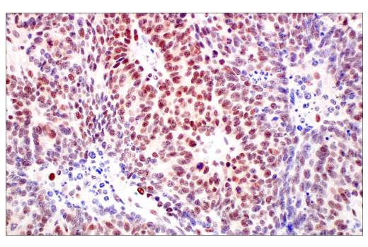 Immunohistochemistry Image 1: MLH1 (ES05) Mouse Monoclonal Antibody