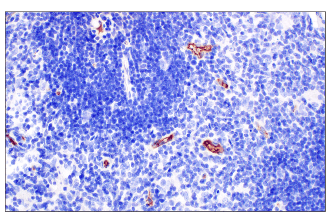 Immunohistochemistry Image 3: PNPLA3 (E7N6O) Rabbit Monoclonal Antibody (BSA and Azide Free)