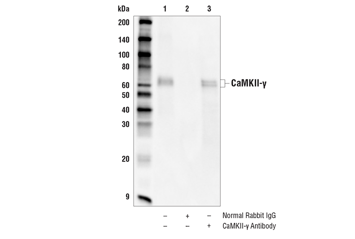 Immunoprecipitation Image 1: CaMKII-gamma Antibody