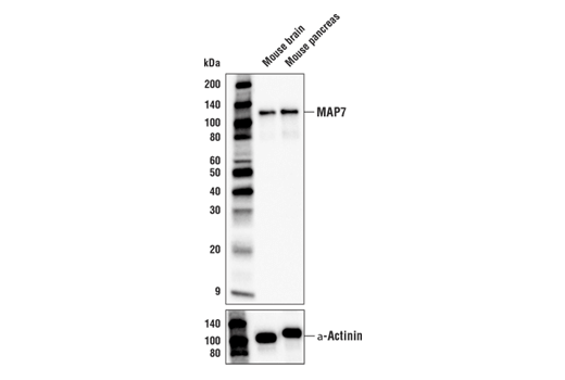 Western Blotting Image 2: MAP7 Antibody