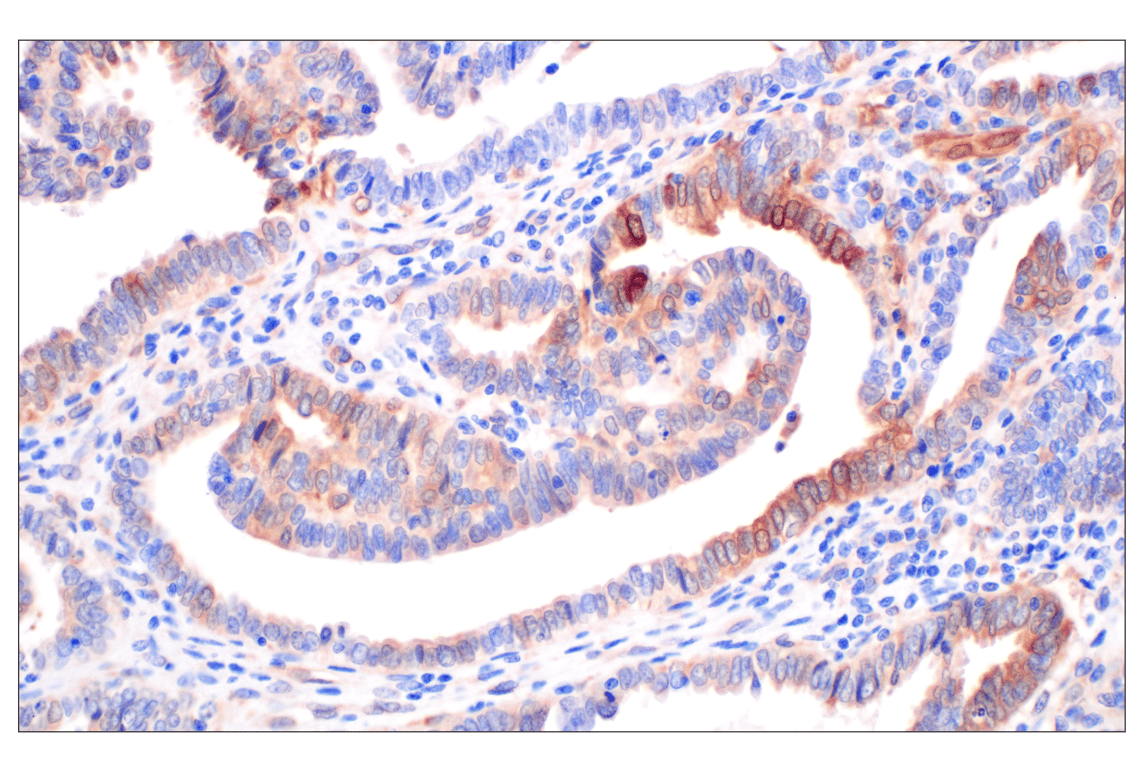 Immunohistochemistry Image 1: cPLA2 (D11H4) Rabbit Monoclonal Antibody