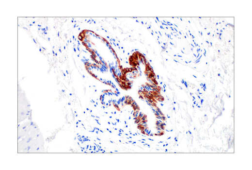 Immunohistochemistry Image 3: Keratin 14 (LL002) Mouse Monoclonal Antibody
