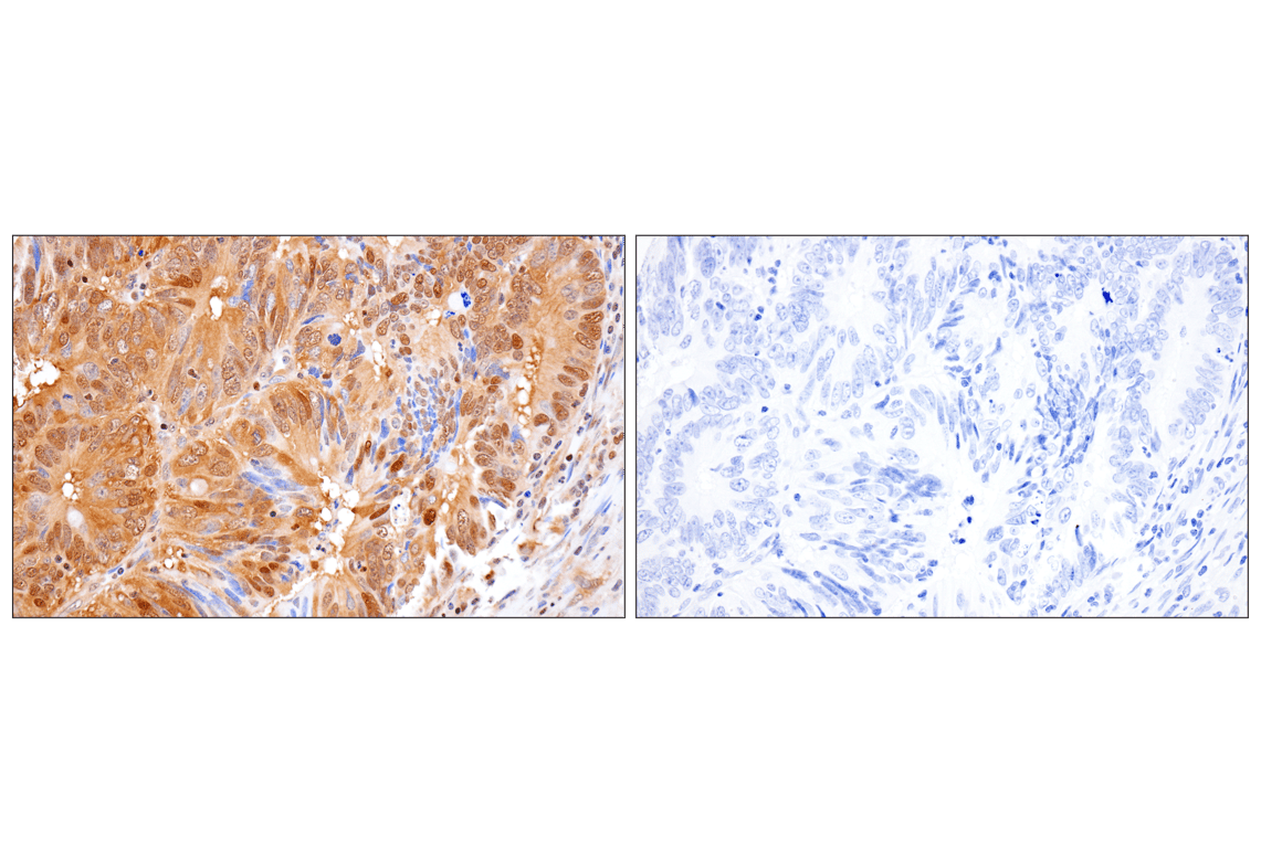 Immunohistochemistry Image 11: Phospho-ATP-Citrate Lyase (Ser455) (F4T8R) Rabbit Monoclonal Antibody
