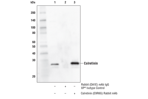 Immunoprecipitation Image 1: Calretinin (E9R6G) Rabbit Monoclonal Antibody