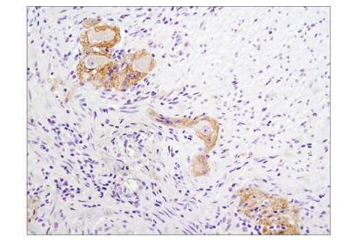 Immunohistochemistry Image 2: N-Cadherin (D4R1H) Rabbit Monoclonal Antibody (BSA and Azide Free)