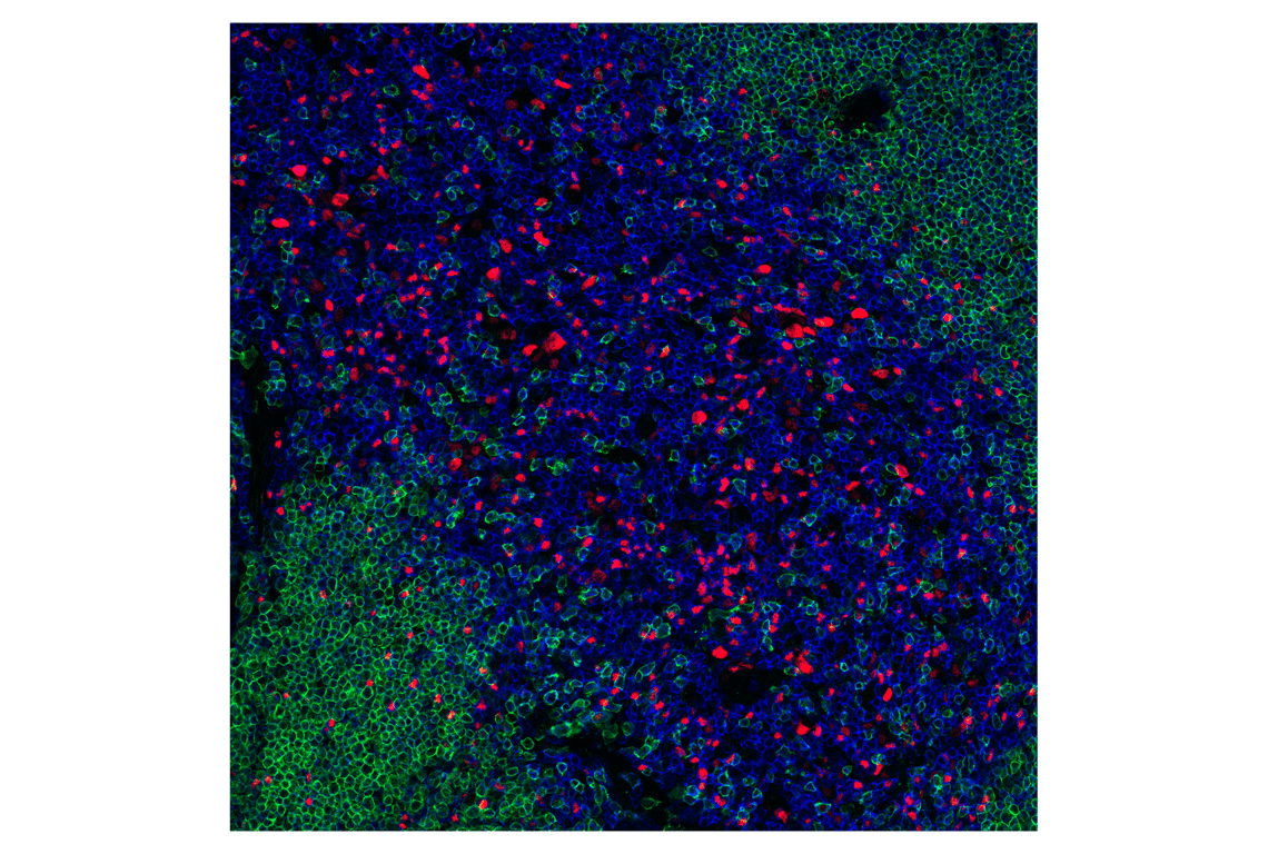 Immunofluorescence Image 1: T-bet/TBX21 (E4I2K) Rabbit Monoclonal Antibody (BSA and Azide Free)