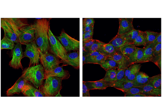 Immunofluorescence Image 1: Acetyl-α-Tubulin (Lys40) (6-11B-1) Mouse mAb