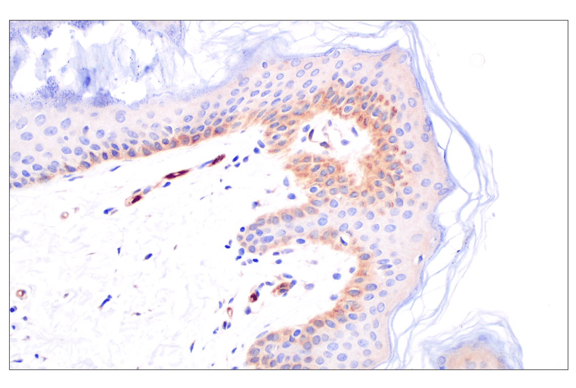 Immunohistochemistry Image 3: cPLA2 (D11H4) Rabbit Monoclonal Antibody