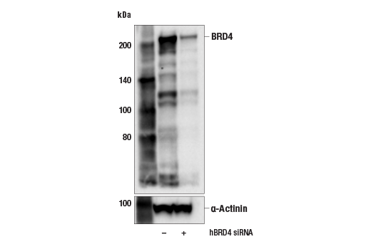 Western Blotting Image 2: BRD4 (E8V7I) Rabbit Monoclonal Antibody