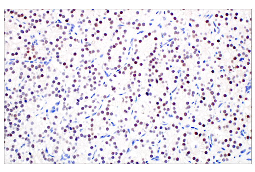 Immunohistochemistry Image 7: POU2F3 (E5N2D) Rabbit Monoclonal Antibody