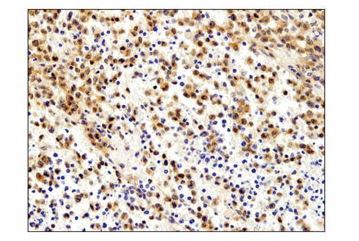 Immunohistochemistry Image 2: Akt1 (D9R8K) Rabbit Monoclonal Antibody