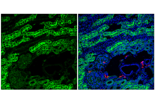 Immunofluorescence Image 1: CMTM6 (E6A8T) Rabbit Monoclonal Antibody