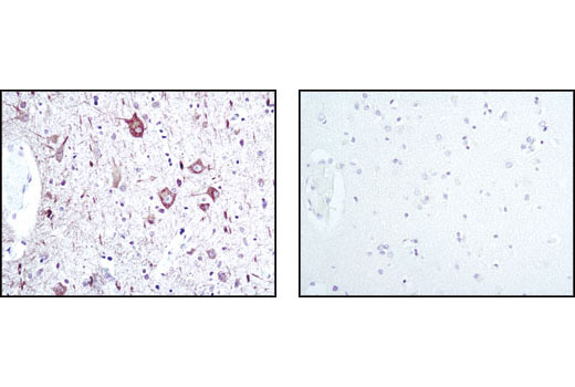Immunohistochemistry Image 1: Neurofilament-L (C28E10) Rabbit Monoclonal Antibody (BSA and Azide Free)