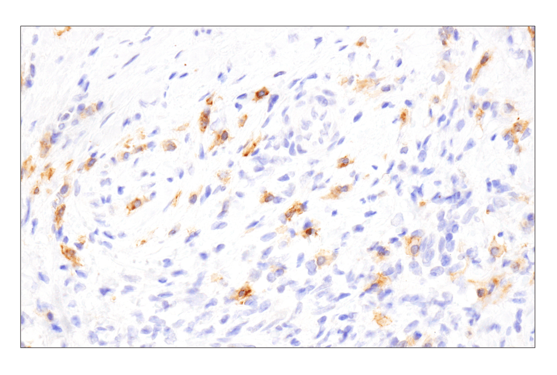 Immunohistochemistry Image 7: TNFRSF17/BCMA (E6D7B) Rabbit Monoclonal Antibody