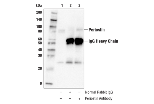 Immunoprecipitation Image 1: Periostin Antibody