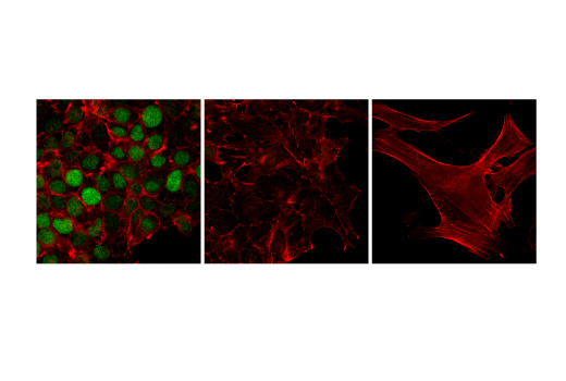 Immunofluorescence Image 1: Phospho-Topoisomerase II alpha (Ser1469) (D4F5) Rabbit Monoclonal Antibody