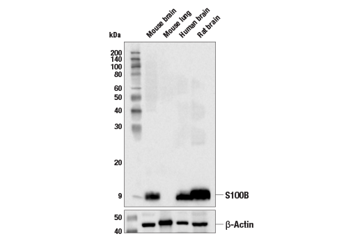 Western Blotting Image 2: S100B (E7C3A) Rabbit Monoclonal Antibody