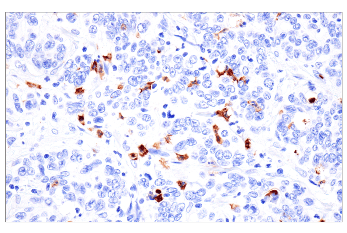Immunohistochemistry Image 2: CD177 (F9O5U) Rabbit Monoclonal Antibody