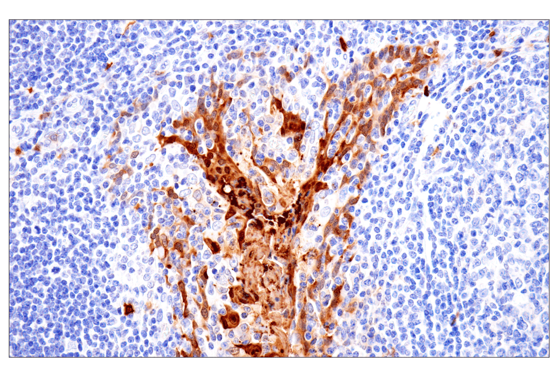 Immunohistochemistry Image 6: S100A8 (F4R2W) Rabbit Monoclonal Antibody (BSA and Azide Free)
