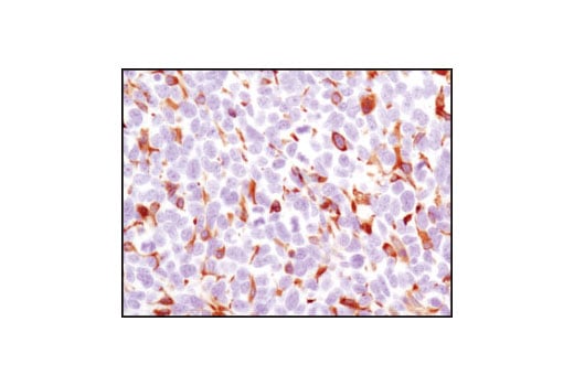 Immunohistochemistry Image 2: HS1 (D5A9) Rabbit Monoclonal Antibody (BSA and Azide Free)