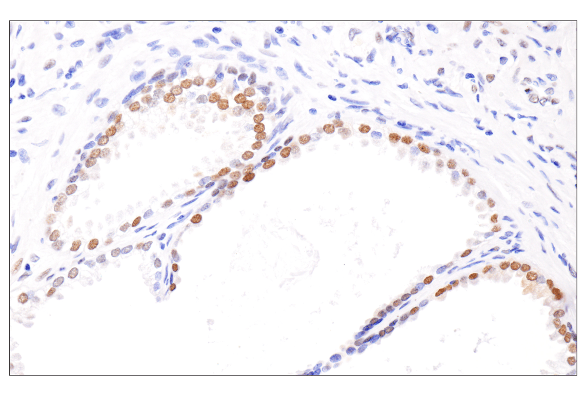 Immunohistochemistry Image 4: Phospho-Stat3 (Ser727) (D4X3C) Rabbit Monoclonal Antibody