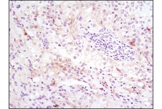 Immunohistochemistry Image 5: Axl (C89E7) Rabbit Monoclonal Antibody