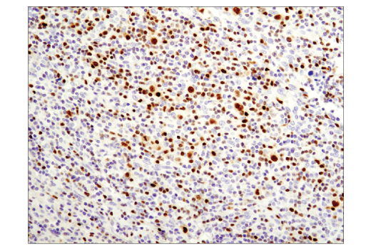 Immunohistochemistry Image 1: T-bet/TBX21 (D6N8B) Rabbit Monoclonal Antibody (BSA and Azide Free)