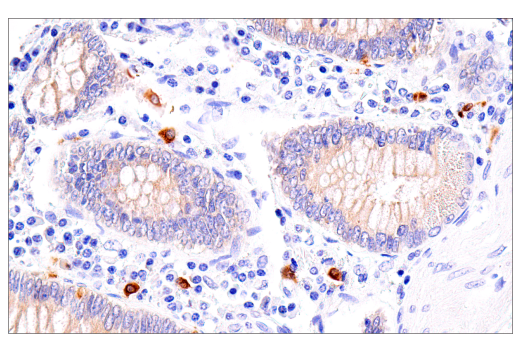 Immunohistochemistry Image 6: Rab27B (E4V3O) Rabbit Monoclonal Antibody