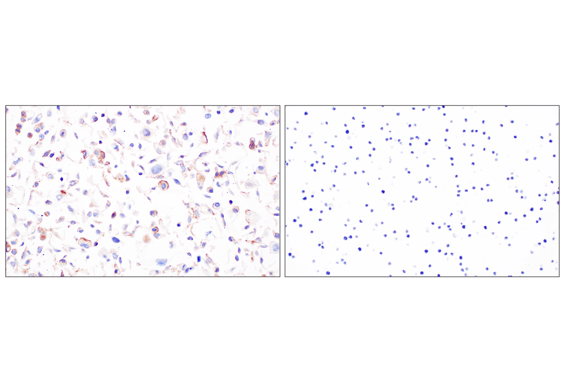 undefined Image 35: Cadherin-Catenin Antibody Sampler Kit