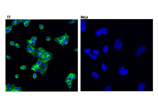 Immunofluorescence Image 1: Ret (D3D8R) Rabbit Monoclonal Antibody (BSA and Azide Free)