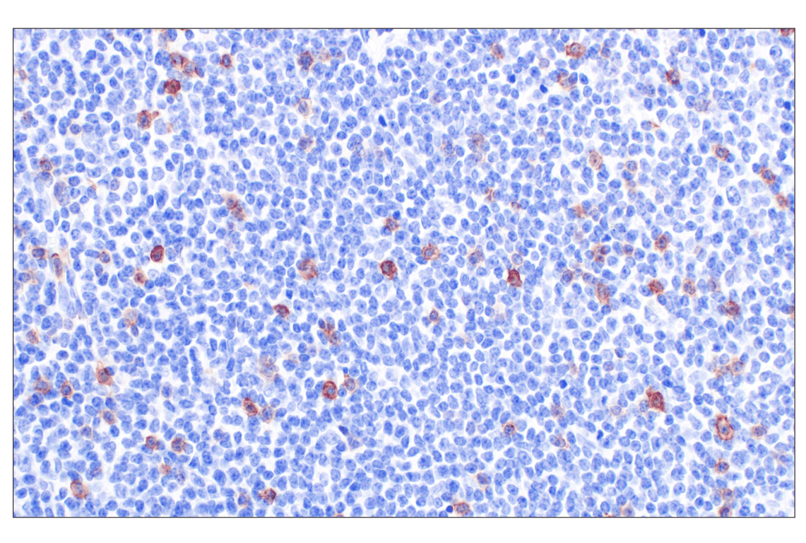 Immunohistochemistry Image 2: CCR4 (F9A9K) Rabbit Monoclonal Antibody